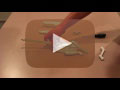 Handle Cover Options Entrygard Truth Hardware Video