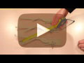 How To Measure Casement Operator Entrygard Truth Hardware Video